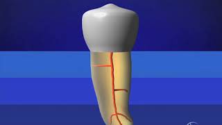 Glide Path Management  Preparation Sequence Advanced Endodontics [upl. by Dloraj]