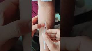 mantoux test kese lagaye [upl. by Rothenberg]