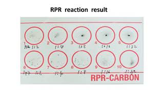 Cerebrospinal Fluid CSF analysis [upl. by Nylrem]