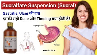 Sucralfate suspension  best medicine for Peptic ulcer  sucral syrup kis kaam mein aata hai  Gas [upl. by Nyleek]