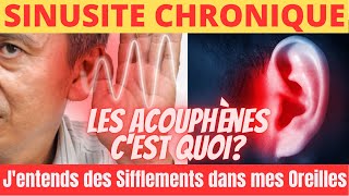 Jentends des Sifflements dans mes Oreilles Acouphènes Que faire Voici Comment sen Débarrasser [upl. by Janek974]