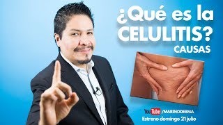 ¿Que es la celulitis y cuales son sus causas Dr Marino Dermatólogo [upl. by Sadowski]