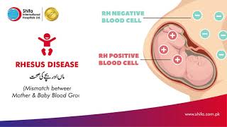 What is Rhesus Disease amp How it affects your baby  Interview with Dr Yasser Masood [upl. by Aihsetan]