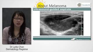 Melanoma Investigations And Oncology [upl. by Nosiddam]