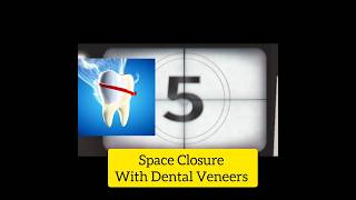 Closing That Gap A Guide to DiastemaSpacing Treatment yt shorts ytshortsindia dentis [upl. by Mossman]