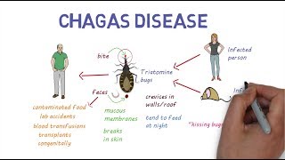 Chagas Disease  An overview [upl. by Fadiman889]