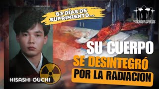 EL HOMBRE MAS RADIOACTIVO DEL MUNDO 83 DIAS DE SUFRIMIENTO HISASHI OUCHI [upl. by Nicholas]