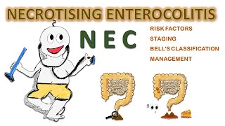 NEC  Necrotizing enterocolitis NEONATOLOGY SERIES CH6 [upl. by Aryek42]