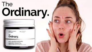 The Ordinary 100 LAscorbic Acid Powder Review  Vitamin C Powder [upl. by Teerprah]