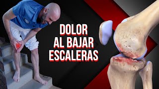 Adiós Dolor De Rodilla En 1 Semana  Cómo Eliminar o Tratar La Inflamación Con Remedios Caseros [upl. by Yesoj]