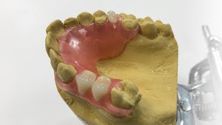 How To Make A Fiber Flex™ Partial  The Entire Process  Dental Lab Learning [upl. by Enelrats]