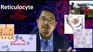 Reticulocyte Medschooldiscussion [upl. by Rorke]