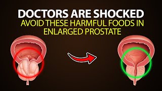 Avoid These Harmful Foods If You Have Enlarged Prostate [upl. by Hegyera]