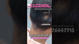 Bache ko Indralupt Alopecia Areata Jaldi hi bilkul theek hoga [upl. by Dalston]