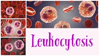 Leukocytosis hematology pathology pathologylab pathologyconcepts [upl. by Nolyat]