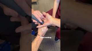 Locked finger contracture physiotherapyclinic painfreelife fingercontractures [upl. by Nivre]