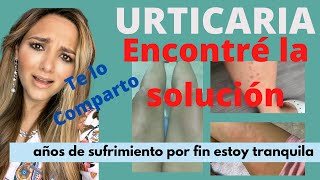 Urticaria Encontré la Solución  soluciones de verdad comprobados [upl. by Brookner405]