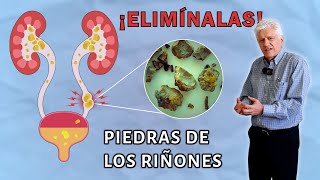 ¿Cómo EVITAR la formación y reaparición de CÁLCULOS RENALES  LITIASIS RENAL🪨 [upl. by Ihp]