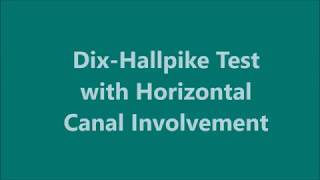 DixHallpike Test with Horizontal Canal Involvement [upl. by Ainot]