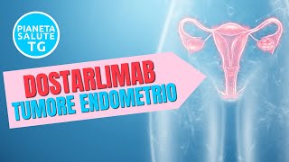 Tumore endometrio terapia combinata carboplatino e taxolo con dostarlimab rivoluziona lapproccio [upl. by Zelde]