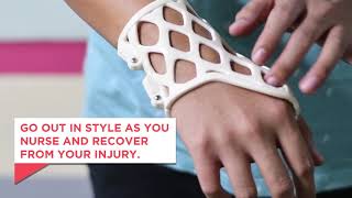 Rehab in Style with 3D Printed Orthopedic Cast [upl. by Akcira633]