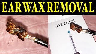 Easy Home Remedies For Removing Ear Wax  Watch Now [upl. by Haran]