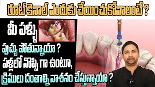 Root Canal Treatment  Painless Single Sitting RCT  Painless Root Canal  Way2Health [upl. by Zehe376]