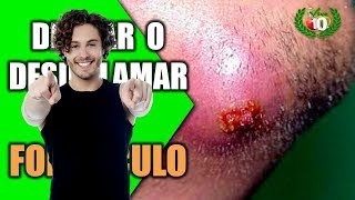 Antibiotic For Boils On Buttocks 🎾 Bringing Boils To A Head Home Remedy [upl. by Larimor]