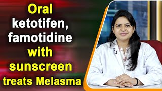 Oral ketotifen famotidine with sunscreen treats Melasma [upl. by Abey]