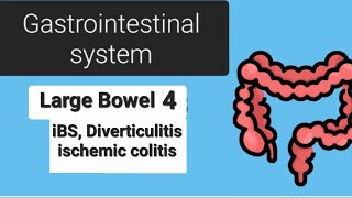 Large Bowel 4 iBS Diverticulitis ischemic colitis [upl. by Ydnam]