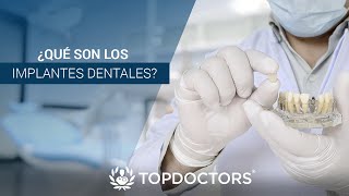 ¿Qué son los implantes dentales [upl. by Sisson]