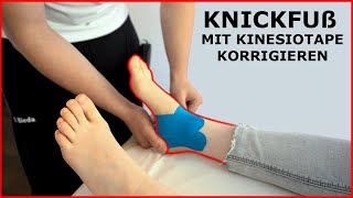 KNICKFUß mit KNIESIOTAPE richtig tapen  Fußfehlstellung richtig korrigieren [upl. by Ainwat]