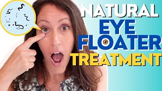 Natural Eye Floater Treatment  4 Ways to Treat Eye Floaters [upl. by Negah]