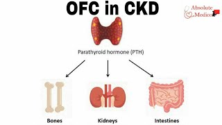 Osteitis Fibrosa Cystica in Chronic Kidney Disease  Part 1 [upl. by Odla820]