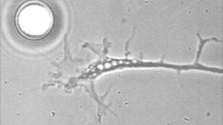 Growth cone guidance by an attractive surface NGFmov [upl. by Elman]