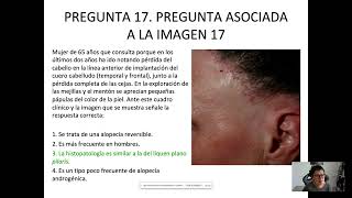 Preguntas de Dermatología MIR 2023 [upl. by Sobmalarah]