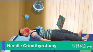 Needle Cricothyrotomy in Virtual Reality and Mixed Reality [upl. by Nala]