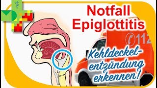 Epiglottitis  Kehldeckelentzündung erkennen und richtig reagieren [upl. by Colver]