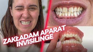 Zakładam Aparat Na Zęby  INVISALIGN  Chodźmy Na Zakupy  jedz pysznie [upl. by Atwater370]