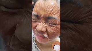 Viral BlackheadsWhiteheads removal skincare Get Glass Skinyoutubeshortsshorts blackheads [upl. by Argyle]