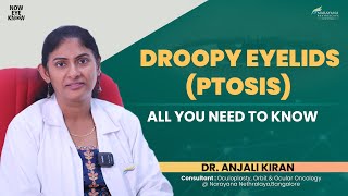 Droopy Eyelids Ptosis Explained  Dr Anjali Kiran  English [upl. by Anaz273]