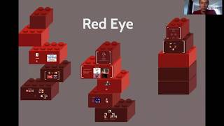 Differential Diagnosis of Red Eye Medical School Lecture [upl. by Akinam]