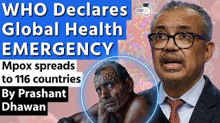 WHO Declares Global Health EMERGENCY  Mpox spreads to 116 countries  By Prashant Dhawan [upl. by Esiuolyram]