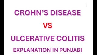 Crohn’s disease vs Ulcerative Colitis punjabi nclex nursing rn nursingofficer nurses india [upl. by Adnorrahs887]