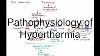 Hyperthermia Pathophysiology [upl. by Yrovi]