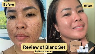 Blanc Set by Beautederm Product Review  Mrs Dee Beauty VLOGS [upl. by Atilef]