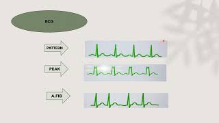 IABP Physiology and normal function [upl. by Zorana]