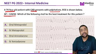 NEET PG Recall 2022 Sustained Monomorphic Ventricular Tachycardia Internal Medicine [upl. by Hardden]