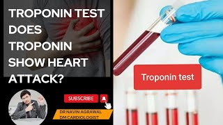 Understanding Troponin Test What You Need to Know Heart Attack Revealedquot [upl. by Ettecul]