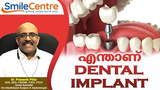 എന്താണ് ഡന്റല്‍ ഇംപ്ലാന്റ്   What is Dental Implant  Dr Prasanth Pillai  Smile Centre India [upl. by Llednik]